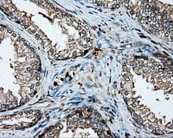 PLEK / Pleckstrin Antibody (clone OTI6H8)