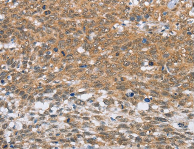 MLH1 Antibody