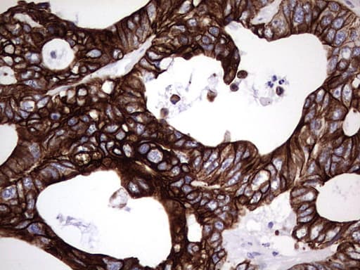Monoclonal Mouse anti-Human KRT19 / CK19 / Cytokeratin 19 Antibody (clone OTI1F5, aa240-390, IHC, WB)