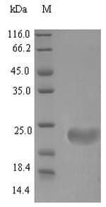 Mouse Defb4 / Defensin Beta 4 Protein (Recombinant 6His-SUMO, N-terminus)