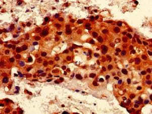 Polyclonal Rabbit anti-Human RIP1 / RALBP1 Antibody (IHC, IF, WB)