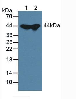 ADK / Adenosine Kinase Antibody (aa1-361)