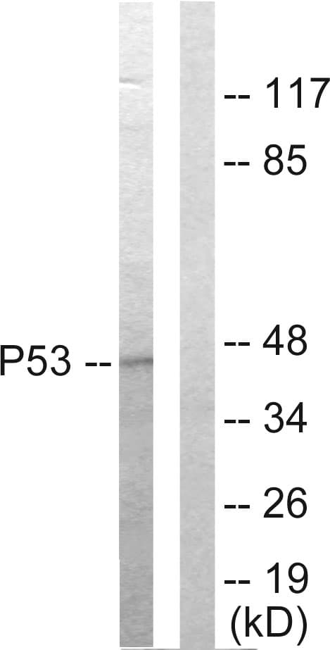 TP53 / p53 Antibody (aa301-350)