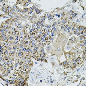 VEPH1 Antibody