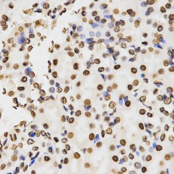 Histone H3 Antibody (Di-Methyl-Lys9)