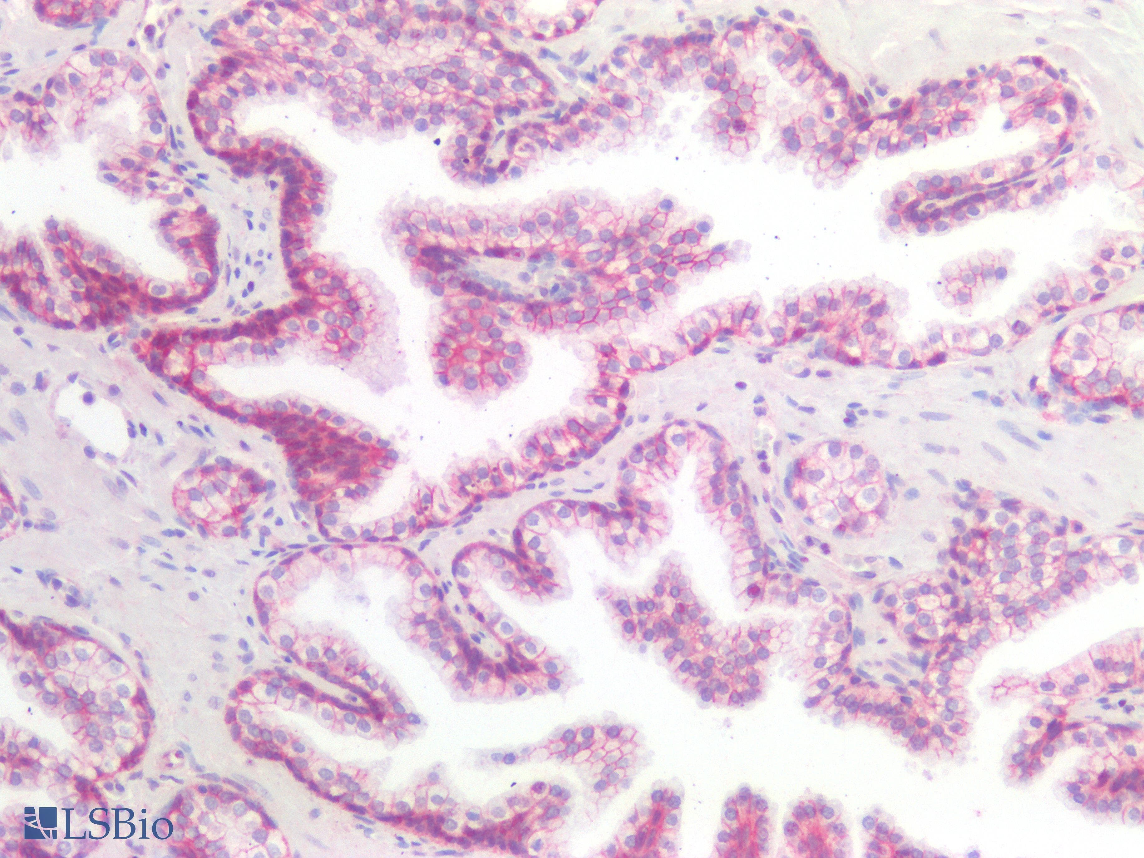 PathPlus™ Polyclonal Rabbit anti-Human CTNND1 / p120 Catenin Antibody (IHC)