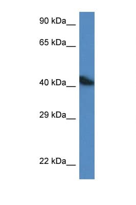 ACTA1 / Skeletal Muscle Actin Antibody (C-Terminus)