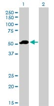 F9 / Factor IX Antibody (clone 2C9)