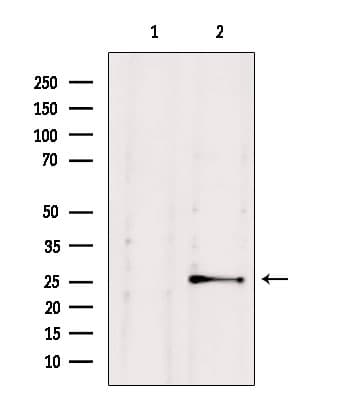 NUDT21 Antibody