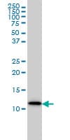S100A9 / MRP14 Antibody (clone 1C10)