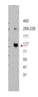 Polyclonal Rabbit anti-Human ABCB5 Antibody (Internal, IHC, WB)