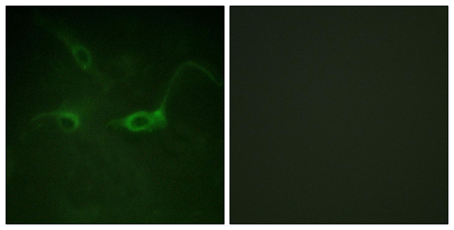 FGFR1 / FGF Receptor 1 Antibody (phospho-Tyr654)