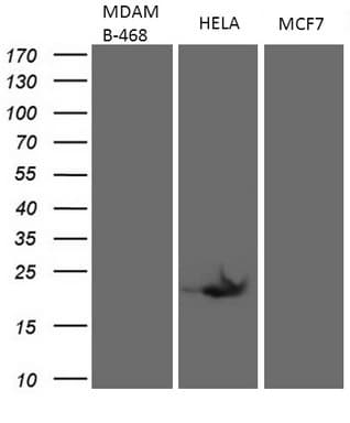 p16INK4a / CDKN2A Antibody (clone OTI3G3)