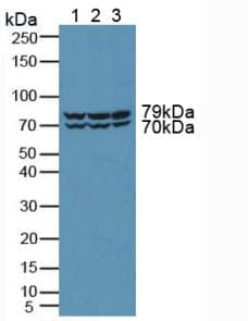 PRKD2 / PKD2 Antibody (aa621-832)