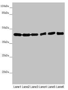 EIF3M / PCID1 Antibody