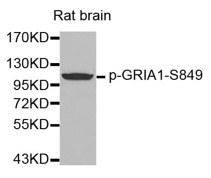 GRIA1 / GLUR1 Antibody (phospho-Ser849)