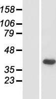 DFNB59 / PJVK Protein (Over-Expression Lysate Myc-DDK (Flag))
