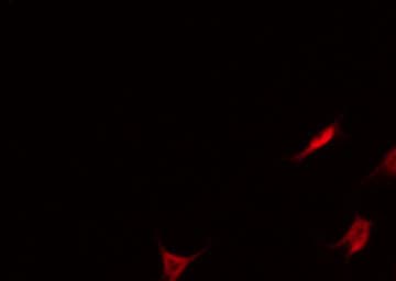 Polyclonal Rabbit anti-Human THBD / CD141 / Thrombomodulin Antibody (IF, WB)