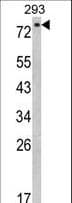 EPS8L3 Antibody (aa1-30)