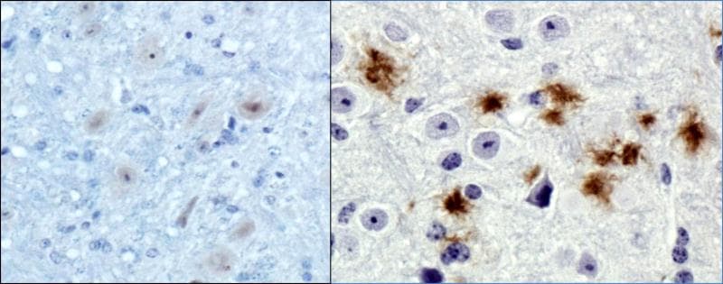 APP / Beta Amyloid Precursor Antibody (clone MOAB-2)