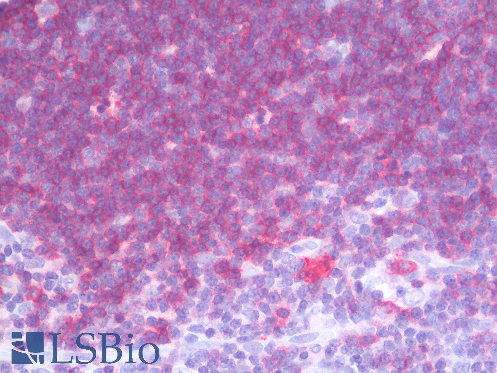 PathPlus™ CD1A Antibody (clone rC1A/711)