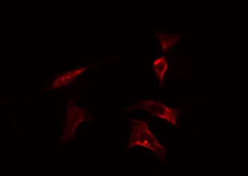 HSP70L1 / HSPA14 Antibody