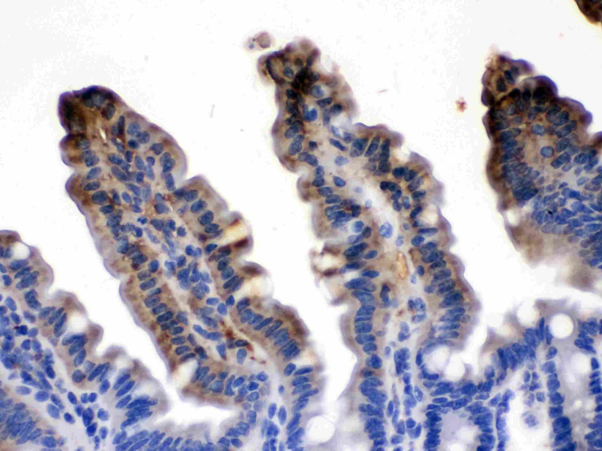 Polyclonal Rabbit anti-Human I-FABP / FABP2 Antibody (IHC, WB)