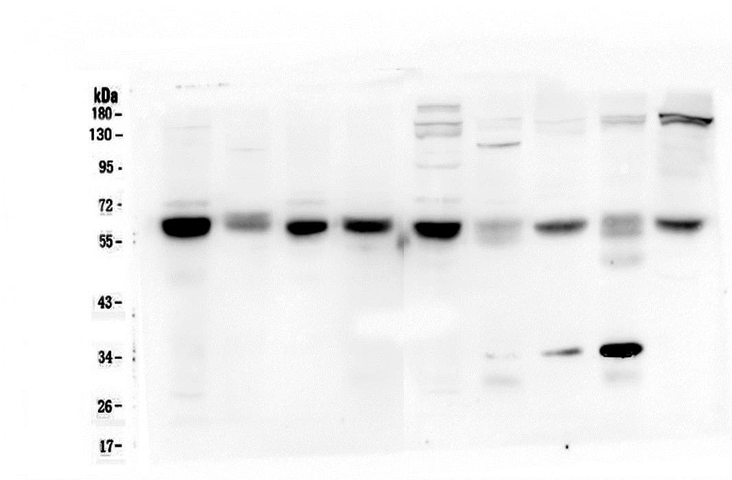 ARSA / Arylsulfatase A Antibody