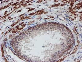 ATRIP Antibody (clone OTI5E7)