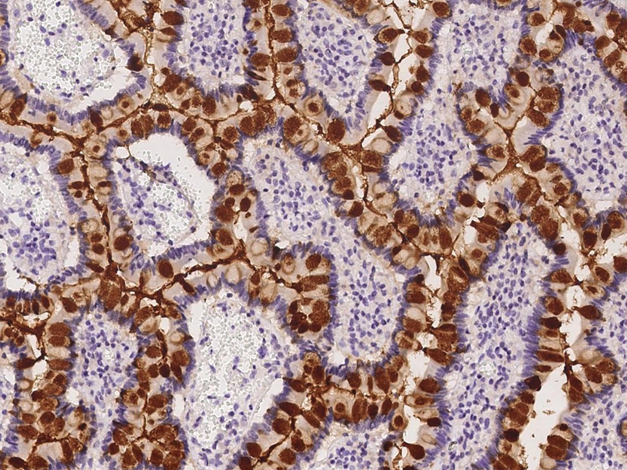 REG4 / REG-IV Antibody