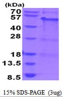 Human MAGEA8 Protein (Recombinant His)