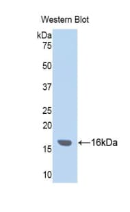 ITIH4 Antibody (aa29-157, FITC)