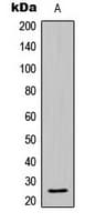 Polyclonal Rabbit anti-Human BCL2L2 / Bcl-w Antibody (C-Terminus, IHC, IF, WB)