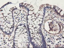 PFKP Antibody (clone OTI2E10)