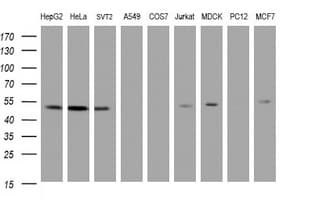 PAI-RBP1 / SERBP1 Antibody (aa1-262, clone OTI1E7)