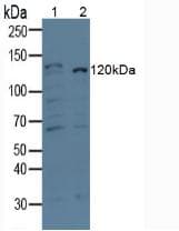 Beta Amyloid 1-42 Antibody (clone C4)