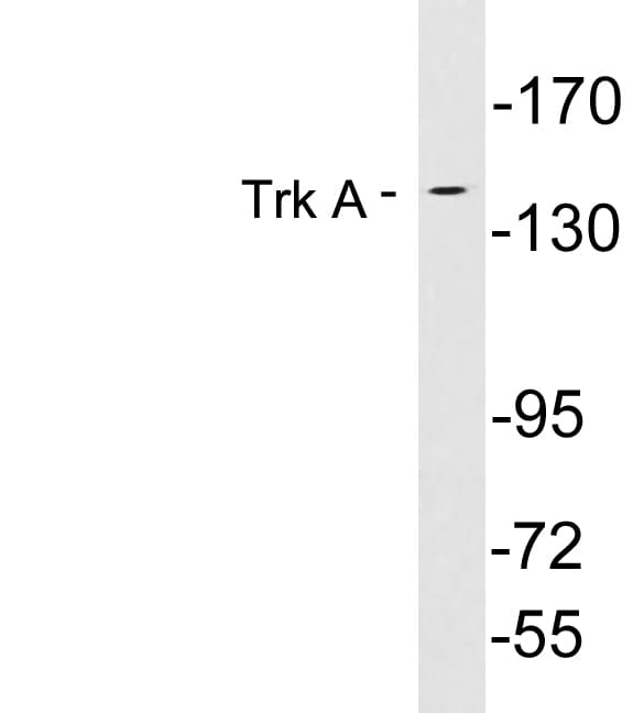 NTRK1 / TrkA Antibody (aa631-680)