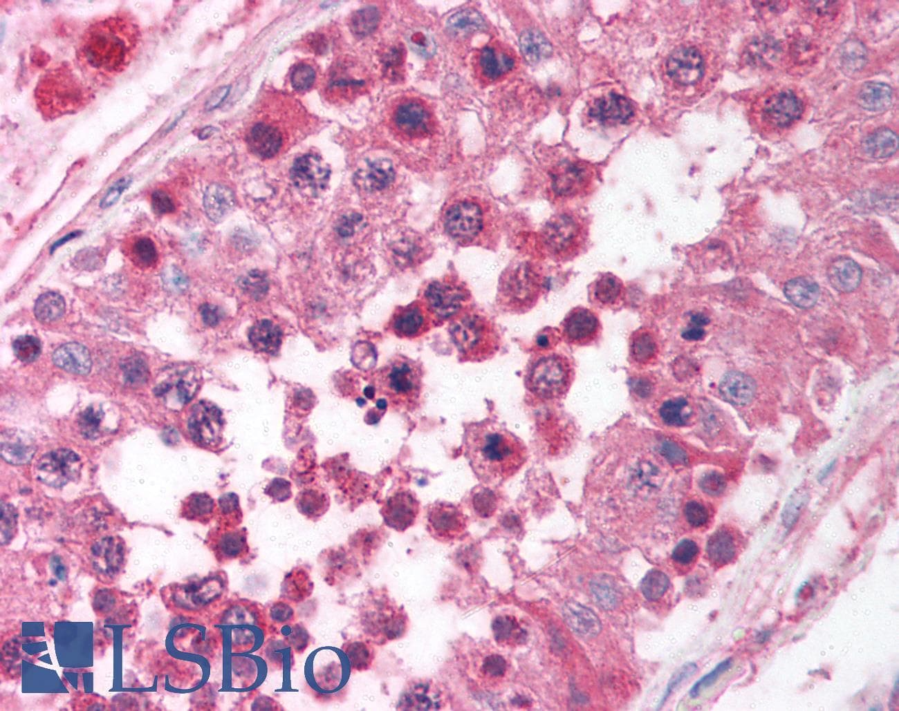 EGR4 / EGR-4 Antibody (C-Terminus)