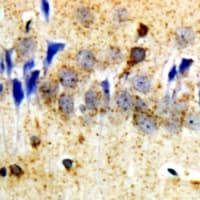Polyclonal Rabbit anti-Human SYNPO / Synaptopodin Antibody (IHC, WB)