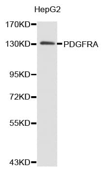 Polyclonal Rabbit anti-Human PDGFRA / PDGFR Alpha Antibody (IHC, WB)