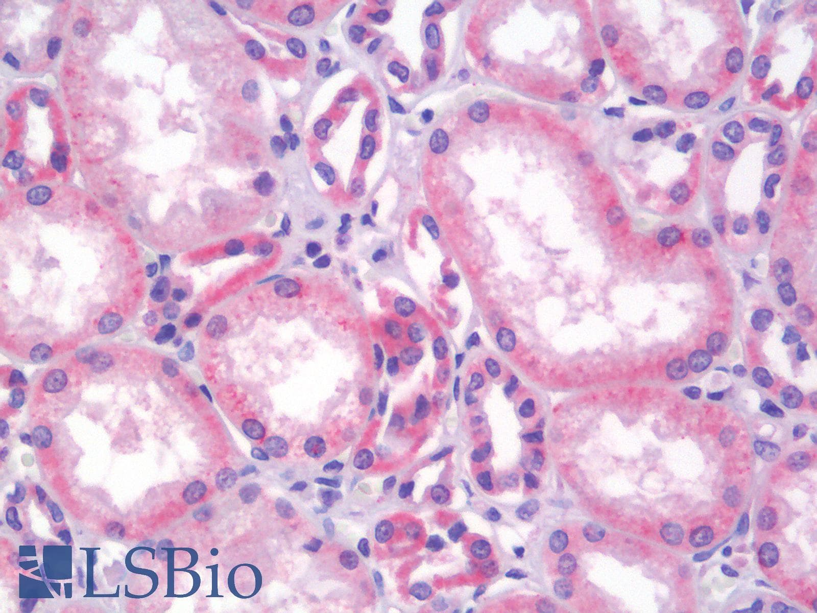 SLC22A3 / OCT3 Antibody (aa46-95)