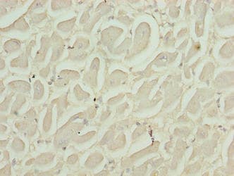 Polyclonal Rabbit anti-Human RASL10B Antibody (IHC)