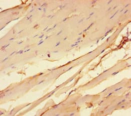 CHRNA1 Antibody
