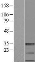 NKG2DL4 / ULBP4 Protein (Over-Expression Lysate Myc-DDK (Flag))