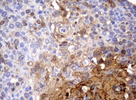 SERPINB4 / SCCA1+2 Antibody (clone UMAB16)