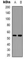 CYP2W1 Antibody (Internal)