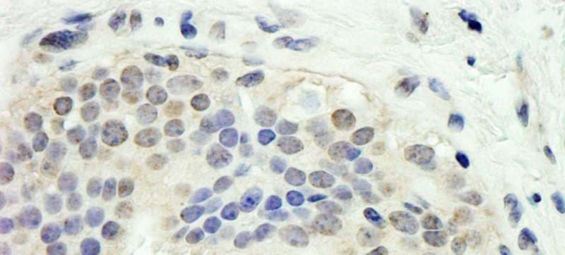 Polyclonal Rabbit anti-Human E2F1 Antibody (aa300-350, IHC)