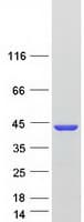 Human BABP / AKR1C2 Protein (Recombinant Myc-DDK (Flag))