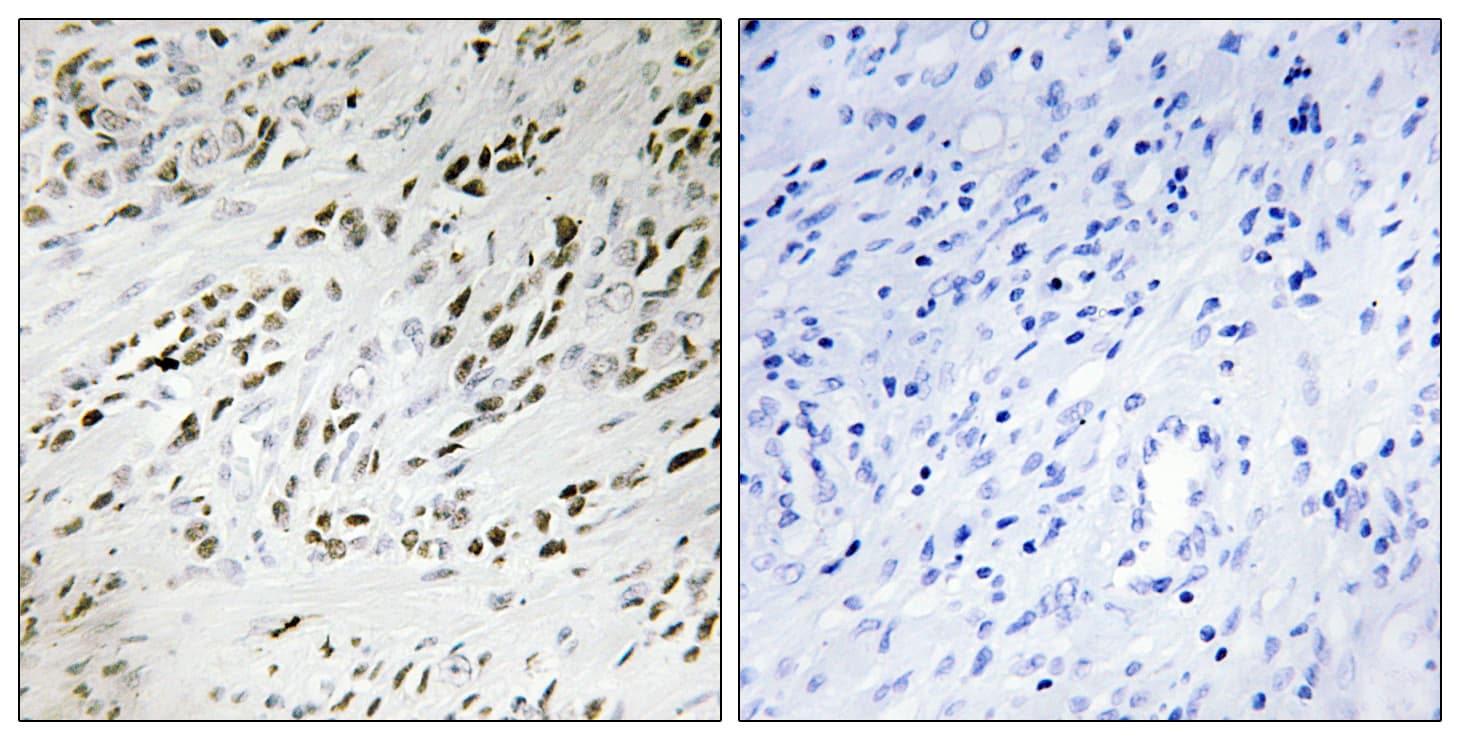 TSHZ2 Antibody (aa811-860)