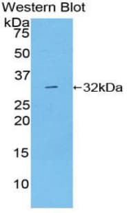 DGKG Antibody (aa451-698)
